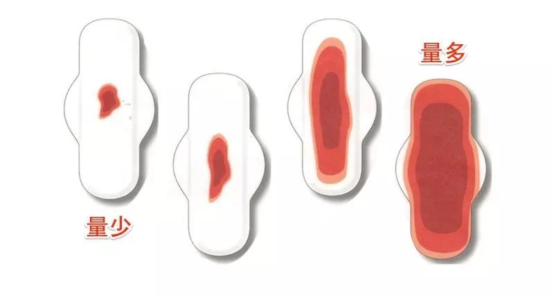 月(yuè)經、氣血、脾胃，直面肌瘤患者的(de)三大(dà)問(wèn)題！